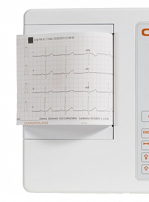 ECGCARDLINEPAPER.jpg